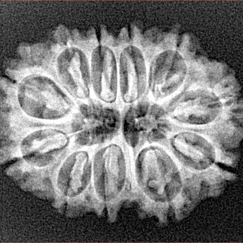 11 Mukhi Rudraksha 26.6mm 3.58gm - Xray