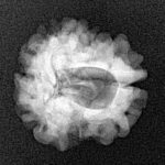 1 Mukhi Rudraksha 20.9mm 2.37gm - Xray