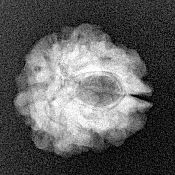 1 Mukhi Rudraksha 17.5mm 2.13gm - Xray