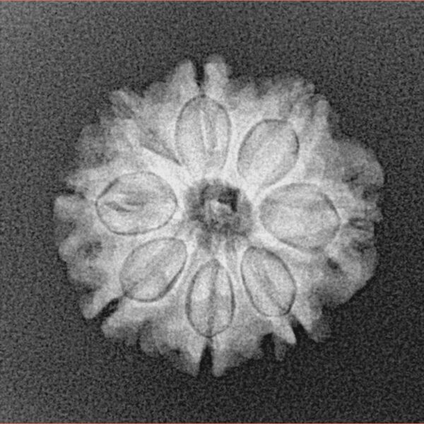 8 Mukhi Rudraksha 19.3mm 2.43gm - Xray