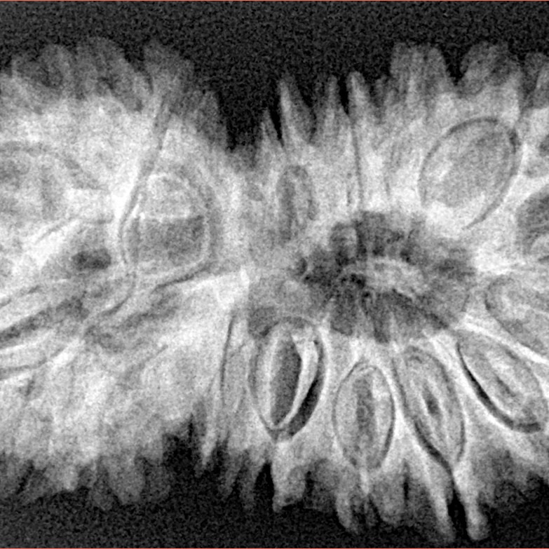 18 MK Gaurishankar 38.4mm 7gm - Xray
