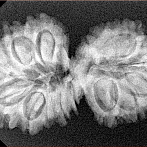 15 MK Gaurishankar 34.8mm 5.25gm - Xray