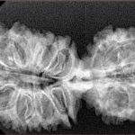 20 MK Gaurishankar 37.8mm 5gm - Xray