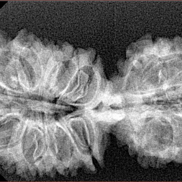 20 MK Gaurishankar 37.8mm 5gm - Xray