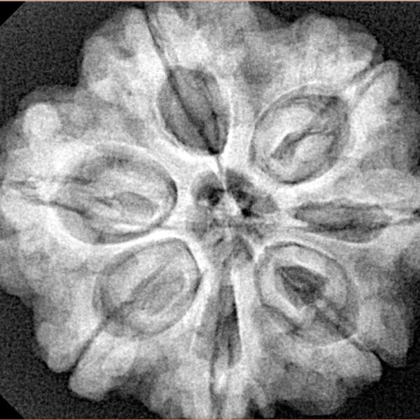 7 Mukhi Rudraksha 28.3mm 7gm - Origin: Nepal - Xray