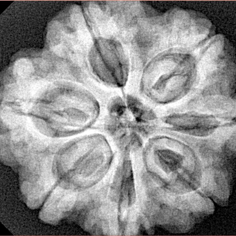 7 Mukhi Rudraksha 28.3mm 7gm - Origin: Nepal - Xray