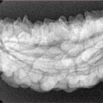 1 Mukhi Rudraksha 42.7mm 6.15gm - Xray