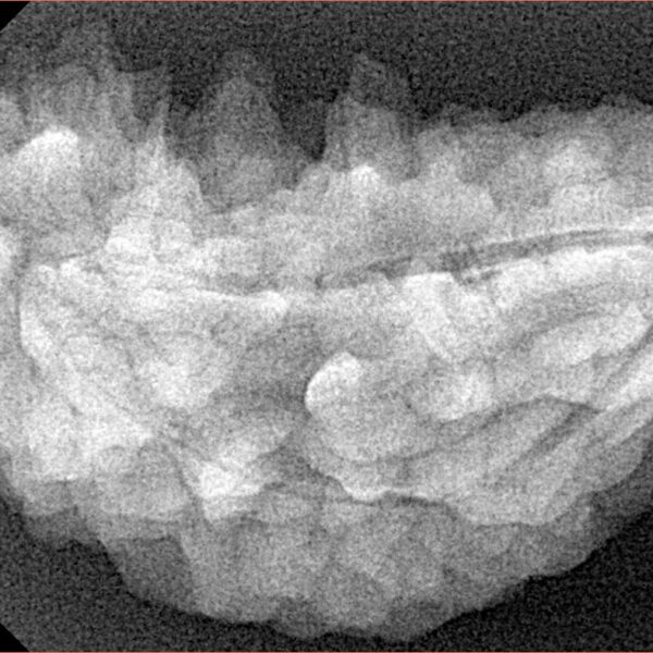 1 Mukhi Rudraksha 38mm 5.59gm - Xray