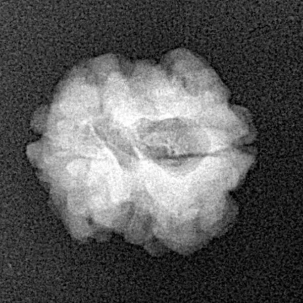 2 Mukhi Rudraksha 18.2mm 1.87gm - Xray