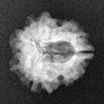 1 Mukhi Rudraksha 19.9mm 2.17gm - Xray