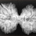 8 MK Gaurishankar 34.5mm 6.86gm - Xray