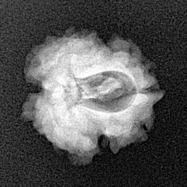 1 Mukhi Rudraksha 18.6mm 1.93gm - Xray