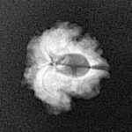 1 Mukhi Rudraksha 17.4mm 1.24gm - Xray