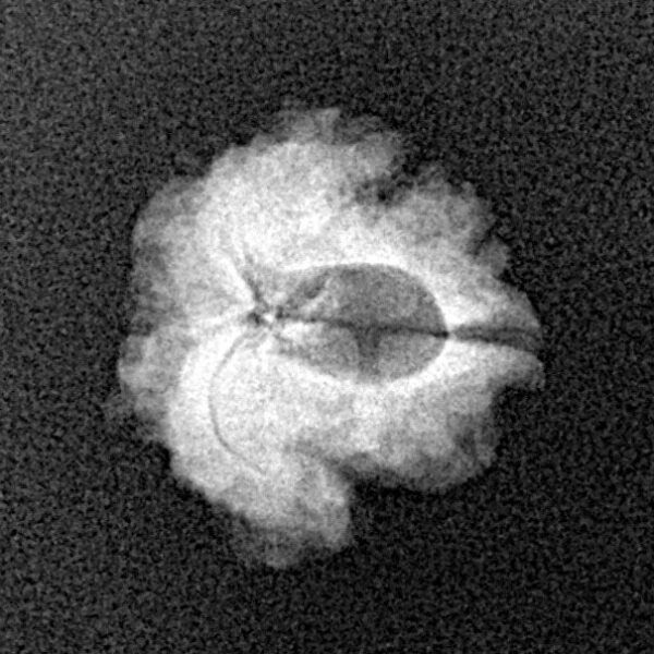 1 Mukhi Rudraksha 17.4mm 1.24gm - Xray