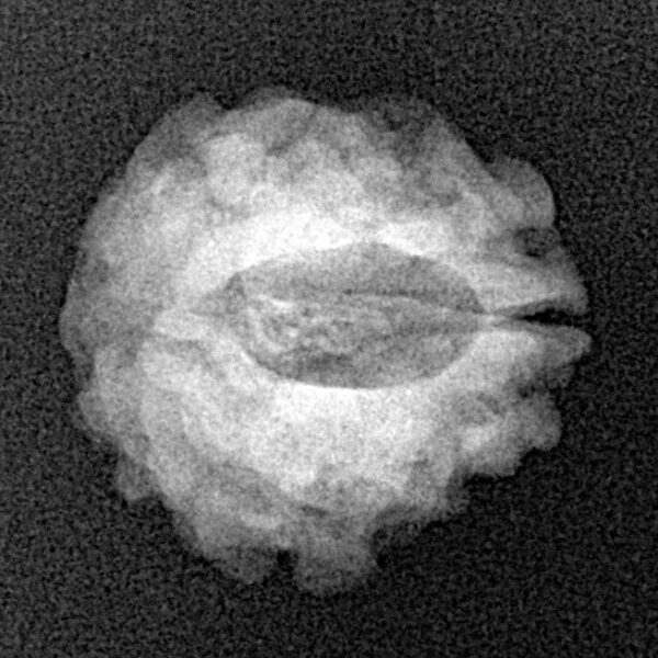 1 Mukhi Rudraksha 18.4mm 2gm - Xray