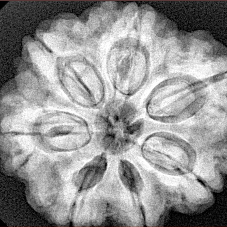 7 Mukhi Rudraksha 28.5mm 7.74gm - Xray