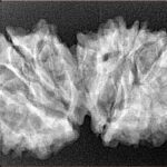 14 Mk Gaurishankar 33.6mm 4.88gm - Xray