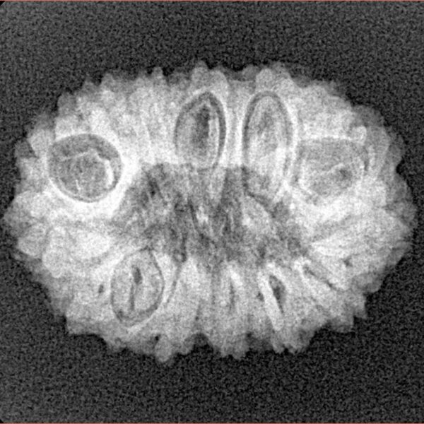 15 Mukhi Rudraksha 24.5mm 3.3gm - Xray