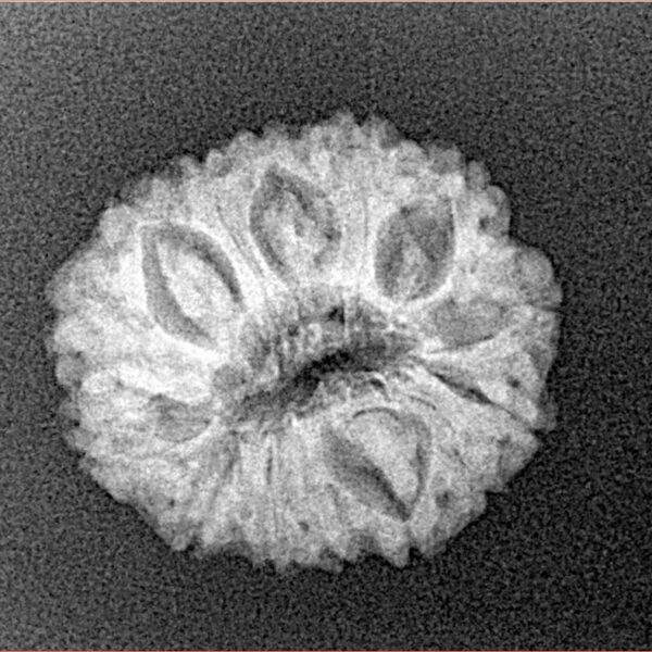 14 Mukhi Rudraksha 19.9mm 2gm - Xray