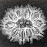 11 Mukhi Rudraksha 25.9mm 3.58gm - Xray