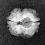 2 Mukhi Rudraksha 17.1mm 1.58gm - Xray