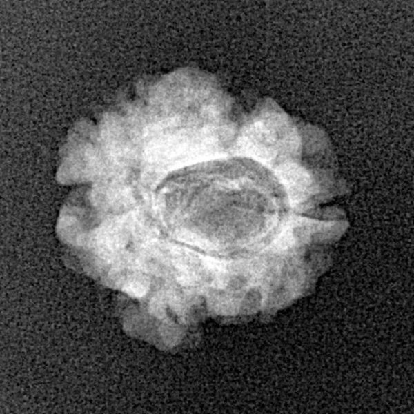 1 Mukhi Rudraksha 16.9mm 1.41gm - Xray