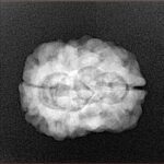 2 Mukhi Rudraksha 27.2mm 3.26gm - Xray