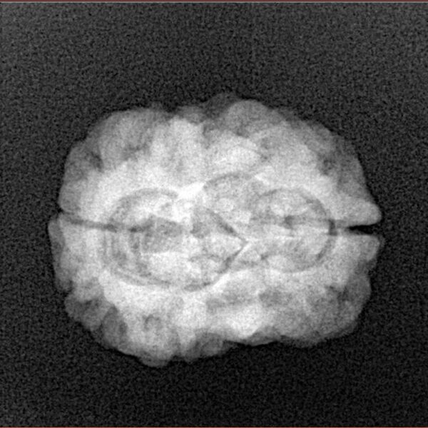 2 Mukhi Rudraksha 27.2mm 3.26gm - Xray