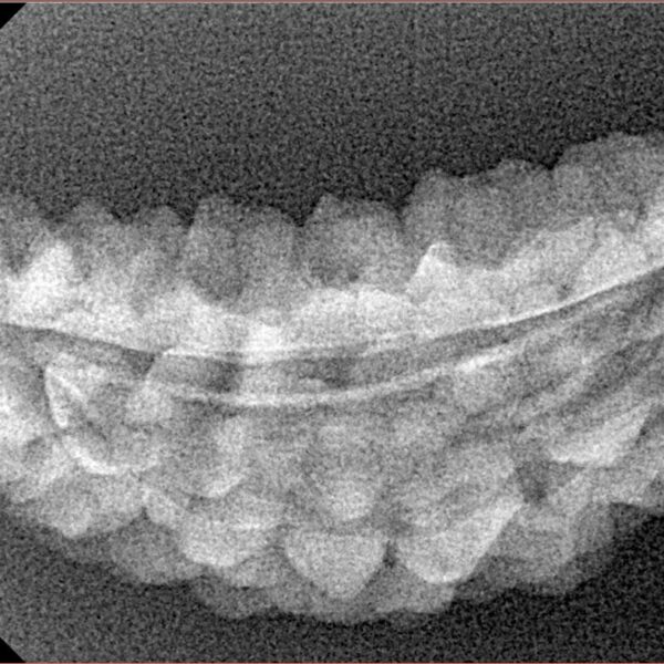 1 Mukhi Rudraksha 42.1mm 3.24gm - Xray