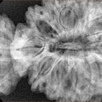 18 MK Gaurishankar 47.1mm 10gm - Xray