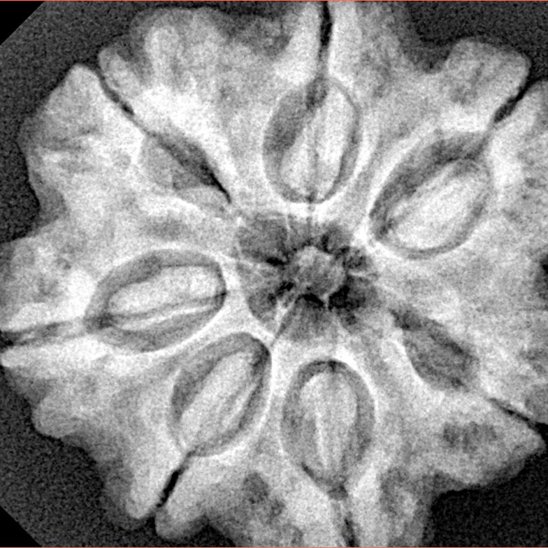 7 Mukhi Rudraksha 28.2mm 6.76gm - Xray