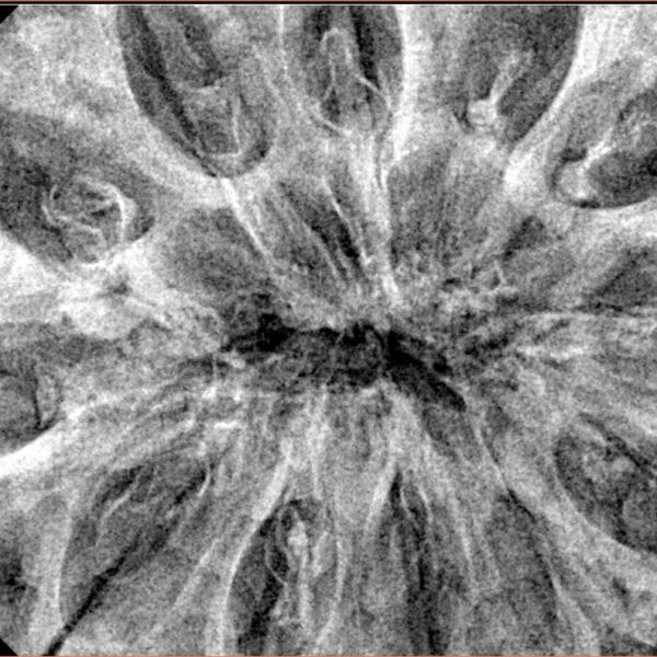 12 Mukhi Rudraksha 44.2mm 12.37gm - Xray