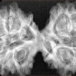 12 MK Gaurishankar 43.6mm 8.81gm - Xray