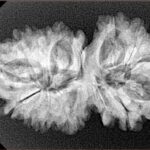 15 MK Gaurishankar 33.9mm 5.18gm - Xray