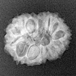 14 Mukhi Rudraksha 19.7mm 2gm - Xray