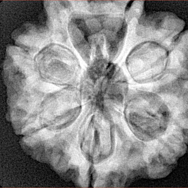 7 Mukhi Rudraksha 28.3mm 7.68gm - Xray