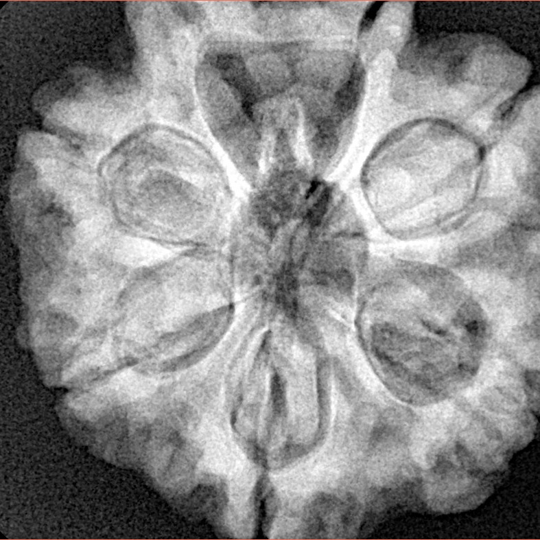7 Mukhi Rudraksha 28.3mm 7.68gm - Xray