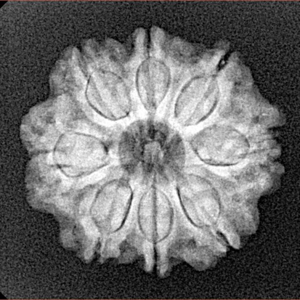 8 Mukhi Rudraksha 22.3mm 3.38gm - Xray