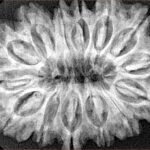 14 Mukhi Rudraksha 34.1mm 6.8gm - Xray