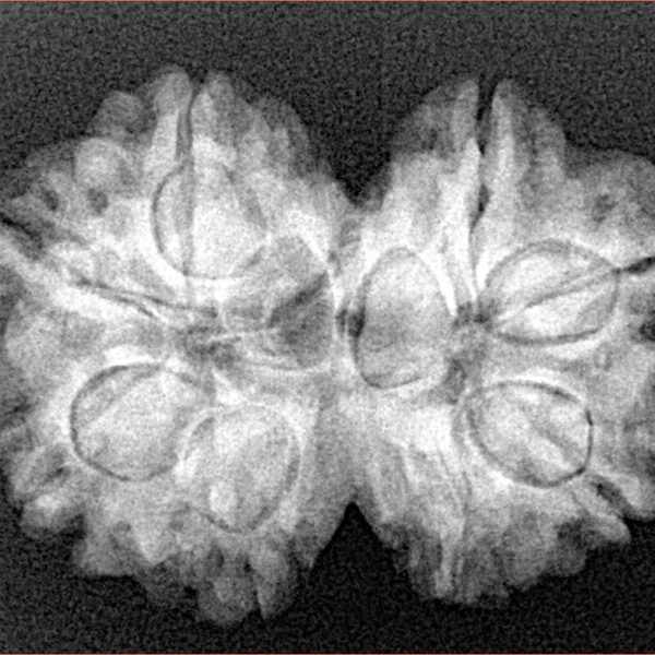8 MK Gaurishankar 28mm 4.71gm - Xray