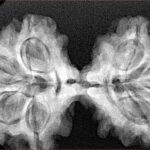 7 MK Gaurishankar 38.6mm 6.86gm - Xray