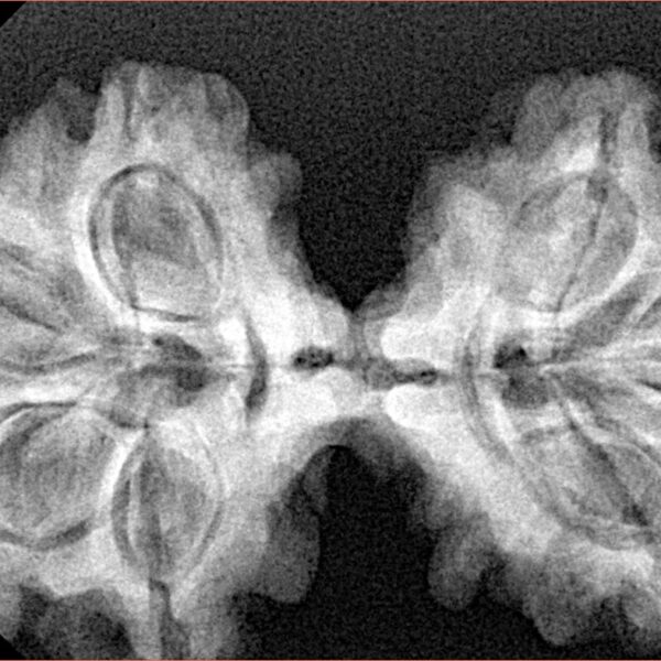 7 MK Gaurishankar 38.6mm 6.86gm - Xray