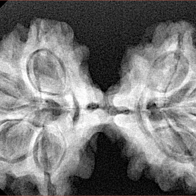 7 MK Gaurishankar 38.6mm 6.86gm - Xray