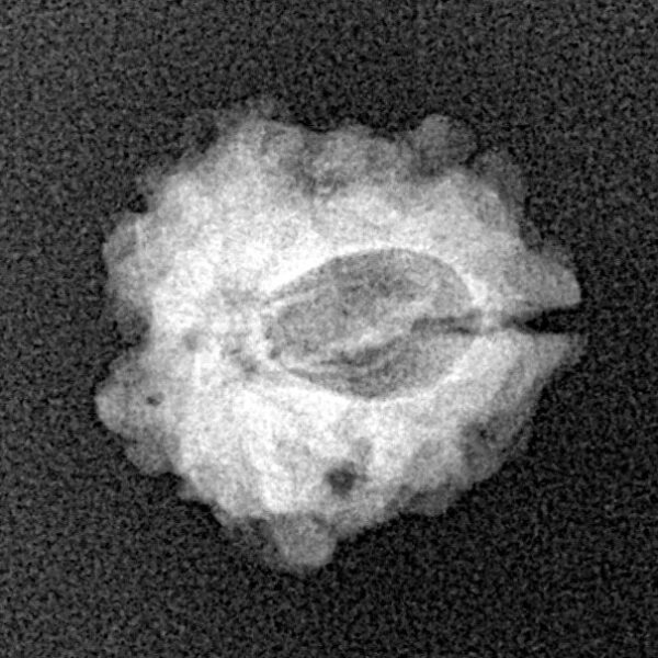 1 Mukhi Rudraksha 15.9mm 1.38gm - Xray