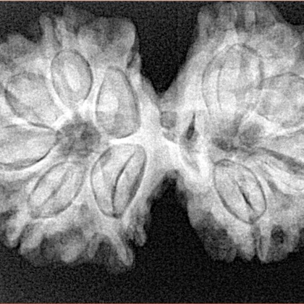 10 Mk Gaurishankar 34mm 6.28gm - Xray