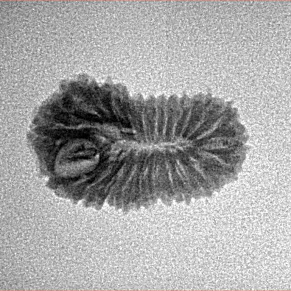 22 Mukhi Rudraksha 19.5mm 1.14gm - Inverse xray