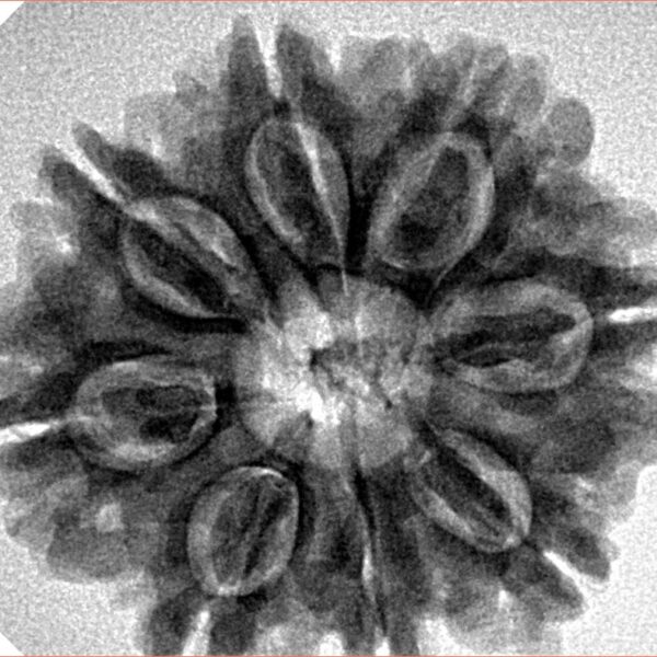 8 Mukhi Rudraksha 27.7mm 5.49gm - Inverse xray