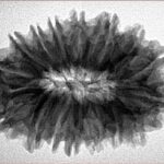 16 Mukhi Rudraksha 30.1mm 5.85gm - Inverse xray
