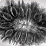 17 Mukhi Rudraksha 34.2mm 7.43gm - Inverse xray