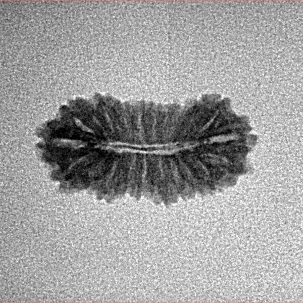 21 Mukhi Rudraksha 18.8mm 0.8gm - Inverse xray